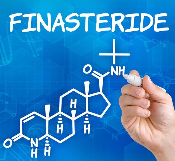 finasterida